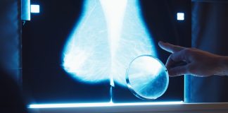 breast density monitoring