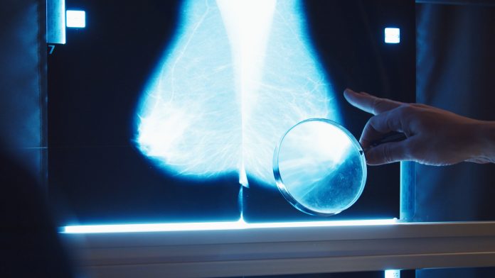 breast density monitoring