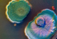 On the trail of microbes: Using bugs to tame urate and advance gout prevention