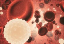 New research highlights gender disparities in sepsis treatment