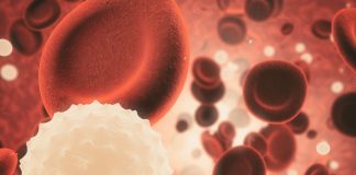 New research highlights gender disparities in sepsis treatment