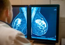 AI better at predicting breast cancer risk than density monitoring, research finds