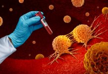 NHS rolls out breakthrough CAR-T therapy for aggressive leukaemia