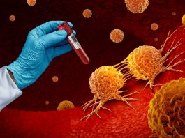 NHS rolls out breakthrough CAR-T therapy for aggressive leukaemia