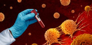 NHS rolls out breakthrough CAR-T therapy for aggressive leukaemia