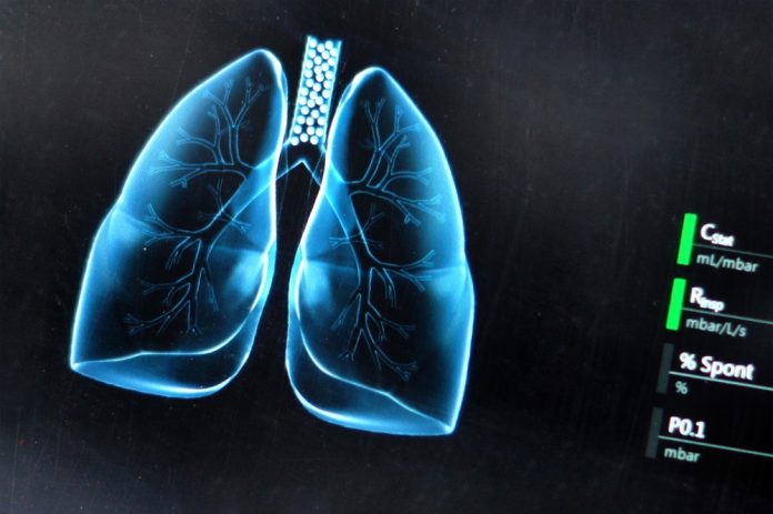 Researchers trial world-first lung cancer vaccine