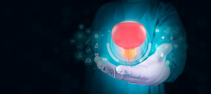 Blood test predicts chemo resistance for men with advanced prostate cancer