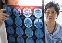 £16.5m UK research drive explores new ways to tackle neurodegenerative diseases neurodegenerative diseases