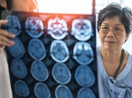 neurodegenerative diseases