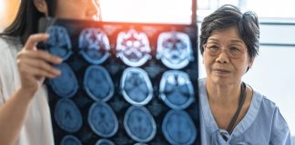 neurodegenerative diseases