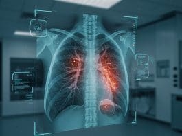 NHS trials AI and robotics to accelerate lung cancer diagnosis