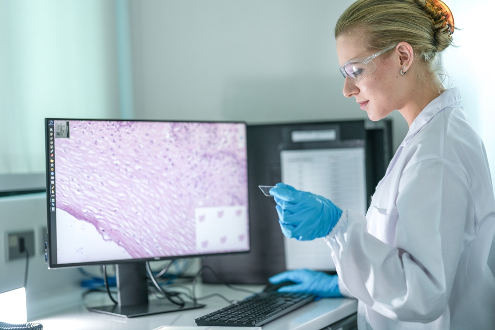 New UK funding tackles local inequalities in cancer screening