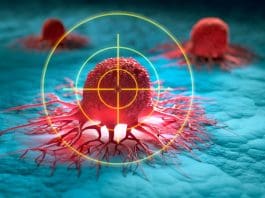 Improved access to clinical trials could improve outcomes for patients with rare cancers